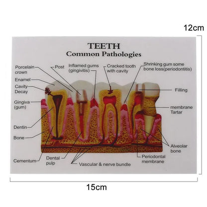 Trendzoy 1pcs Fully Anatomical Teeth Model For Studying Teaching Demonstration Dentist Dental Models For Patient Education Dentistry Products